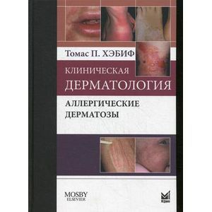 Фото Клиническая дерматология. Аллергические дерматозы
