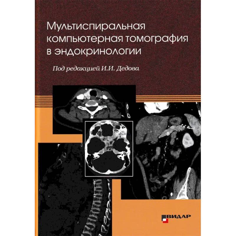 Фото Мультиспиральная компьютерная томография в эндокринологии