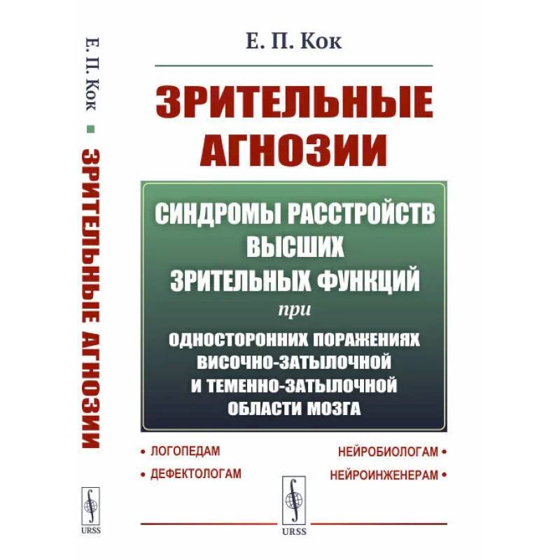 Фото Синдромы расстройств высших зрительных функций при односторонних поражениях височно-затылочной и теменно-затылочной области мозга