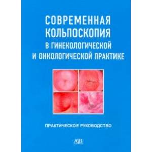 Фото Современная кольпоскопия в гинекологической и онкологической практике