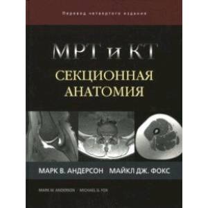 Фото МРТ и КТ. Секционная анатомия