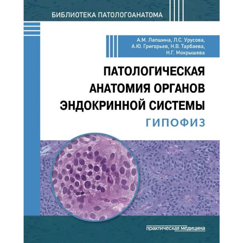 Фото Патологич анатомия органов эндокр системы. Гипофиз