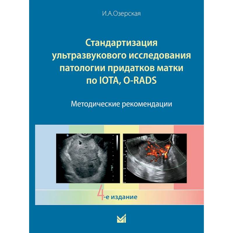Фото Стандартизация ультразвукового исследования патологии придатков матки по IOTA, O-RADS. Методические рекомендации. 4-е издание