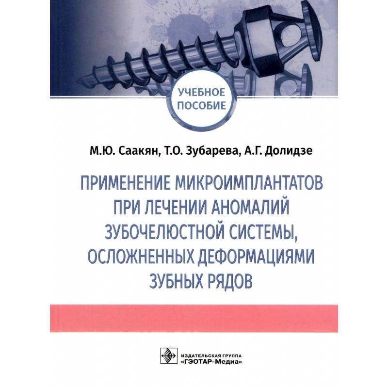 Фото Применение микроимплантатов при лечении аномалий зубочелюстной системы, осложненных деформациями