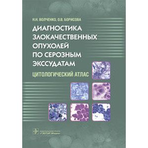 Фото Диагностика злокачественных опухолей по серозным экссудатам. Цитологический атлас