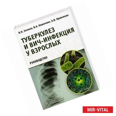 Фото Туберкулез и ВИЧ-инфекция у взрослых.Руководство