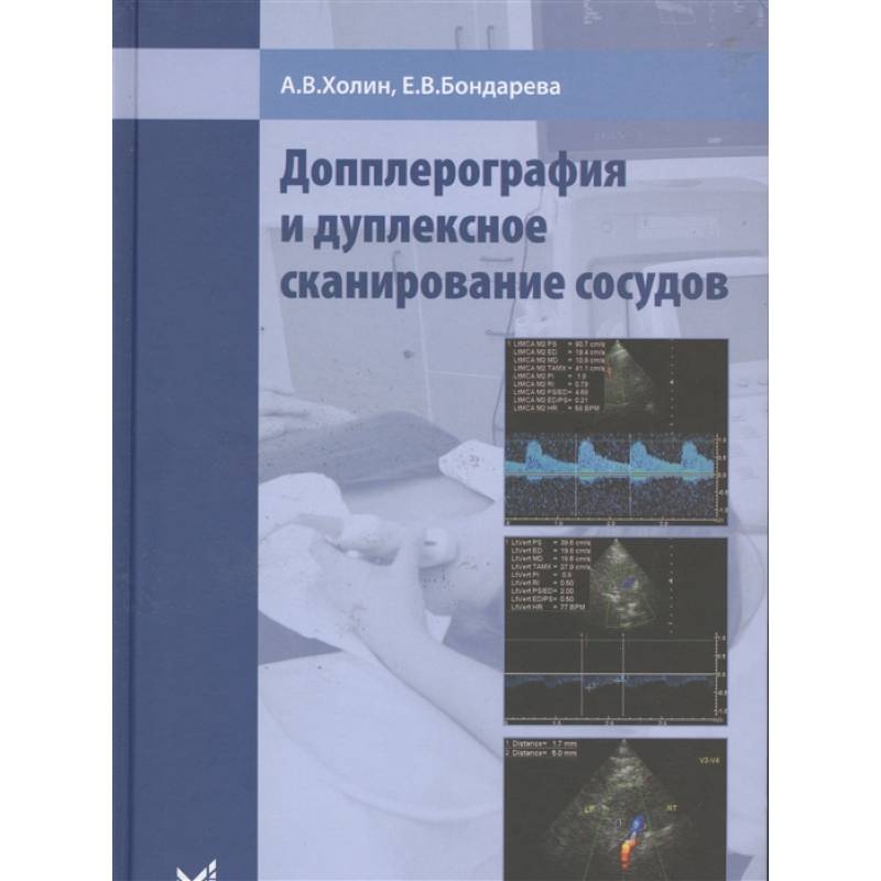 Фото Допплерография и дуплексное сканирование сосудов. Холин