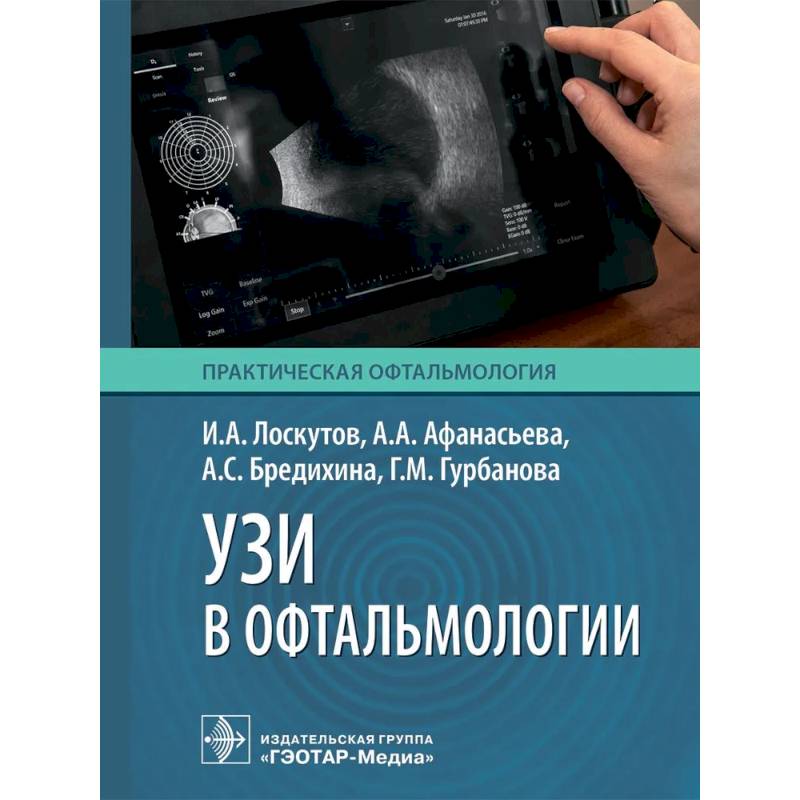 Фото УЗИ в офтальмологии