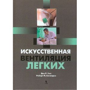 Фото Искусственная вентиляция легких