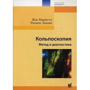 Фото Кольпоскопия. Метод и диагностика