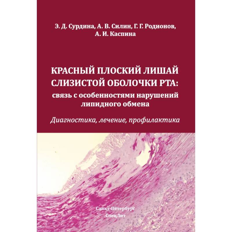 Фото Красный плоский лишай слизистой оболочки рта: связь с особенностями нарушений липидного обмена. Диагностика, лечение, профилактика