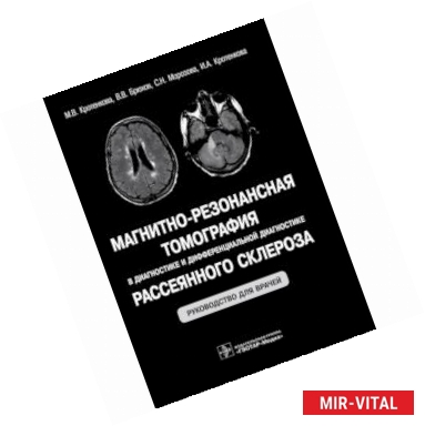 Фото Магнитно-резонансная томография в диагностике и дифференциальной диагностике рассеянного склероза