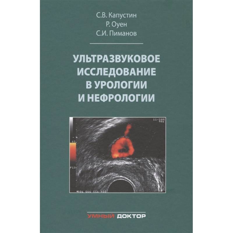 Фото Ультразвуковое исследование в урологии и нефрологии