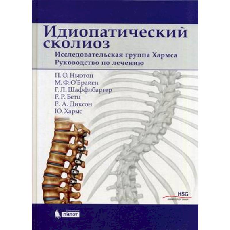 Фото Идиопатический сколиоз. Исследовательская группа Хармса. Руководство по лечению