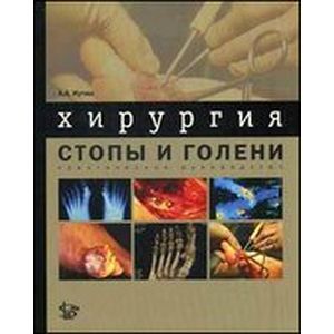 Фото Хирургия стопы и голени: практическое руководство