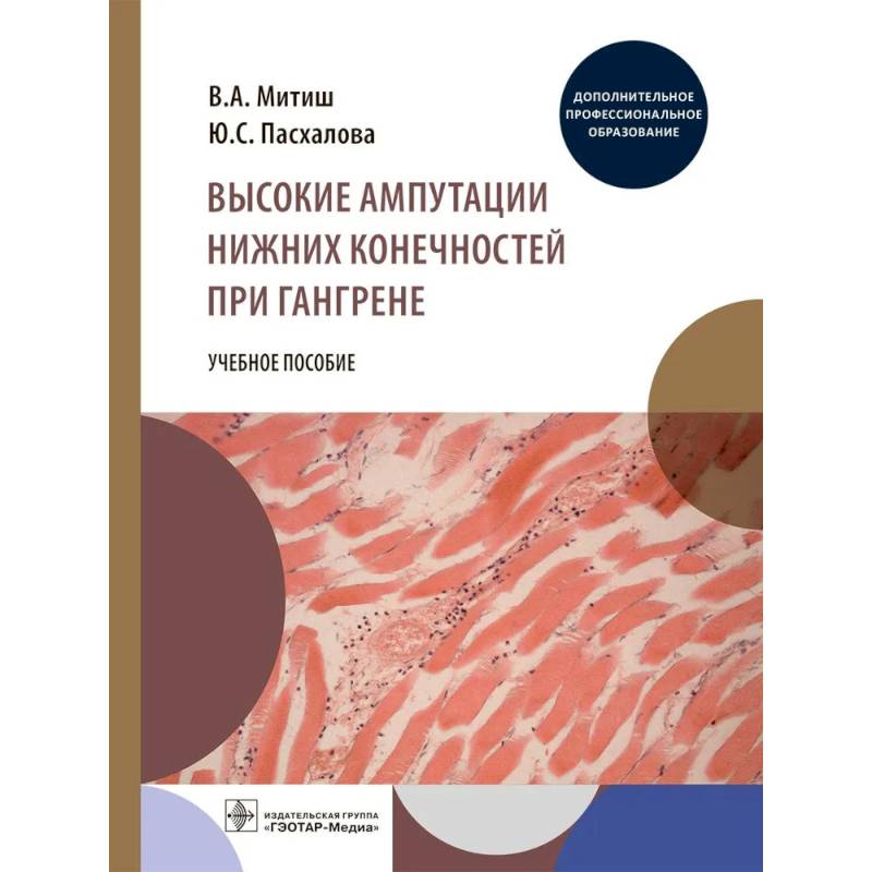 Фото Высокие ампутации нижних конечностей при гангрене: Учебное пособие