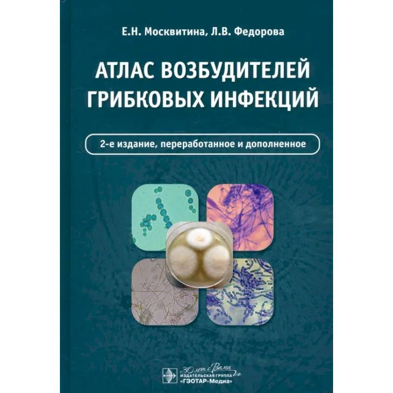 Фото Атлас возбудителей грибковых инфекций