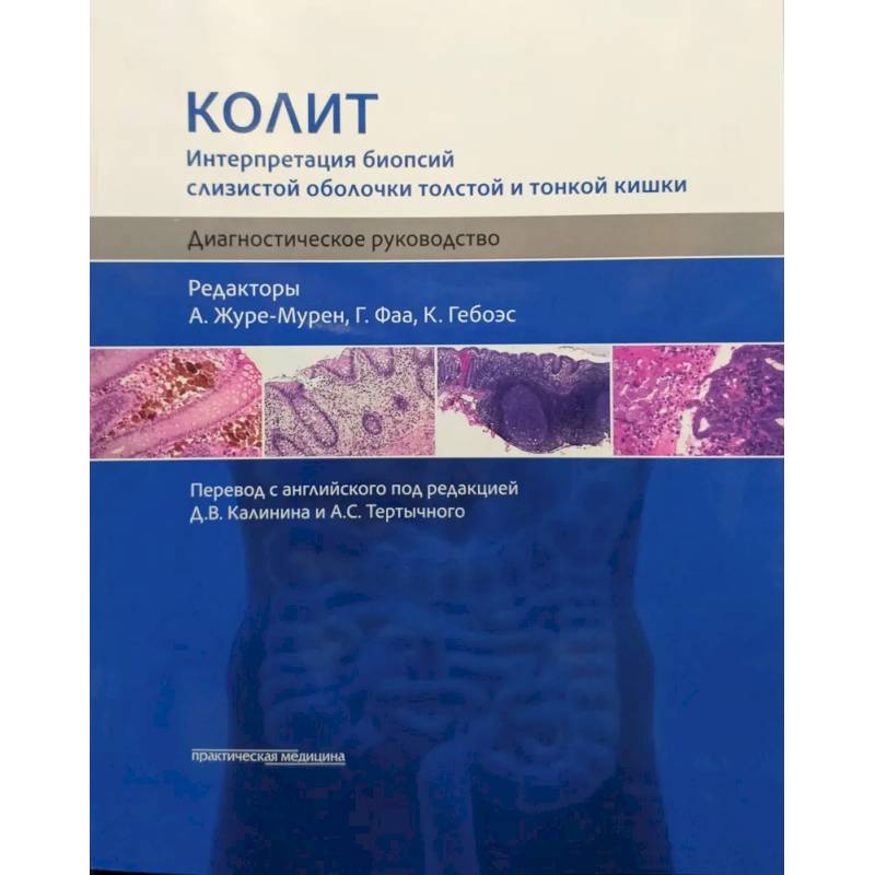 Фото Колит. Интерпретация биопсий слизистой оболочки толстой и тонкой кишки. Диагностическое руководство
