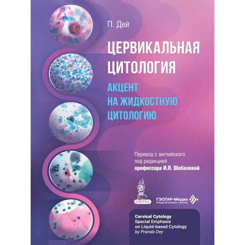 Фото Цервикальная цитология. Акцент на жидкостную цитологию