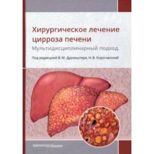 Фото Хирургическое лечение цирроза печени. Мультидисциплинарный подход. Монография