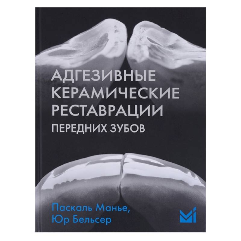 Фото Адгезивные керамические реставрации передних зубов