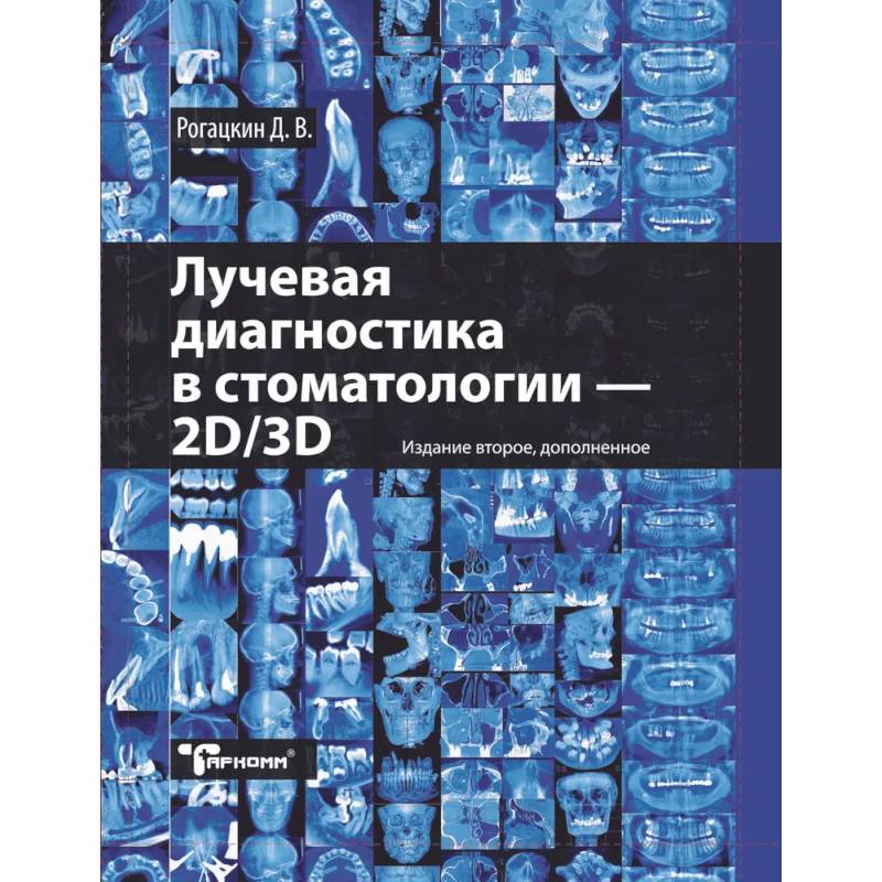 Фото Лучевая диагностика в стоматологии: 2D/3D