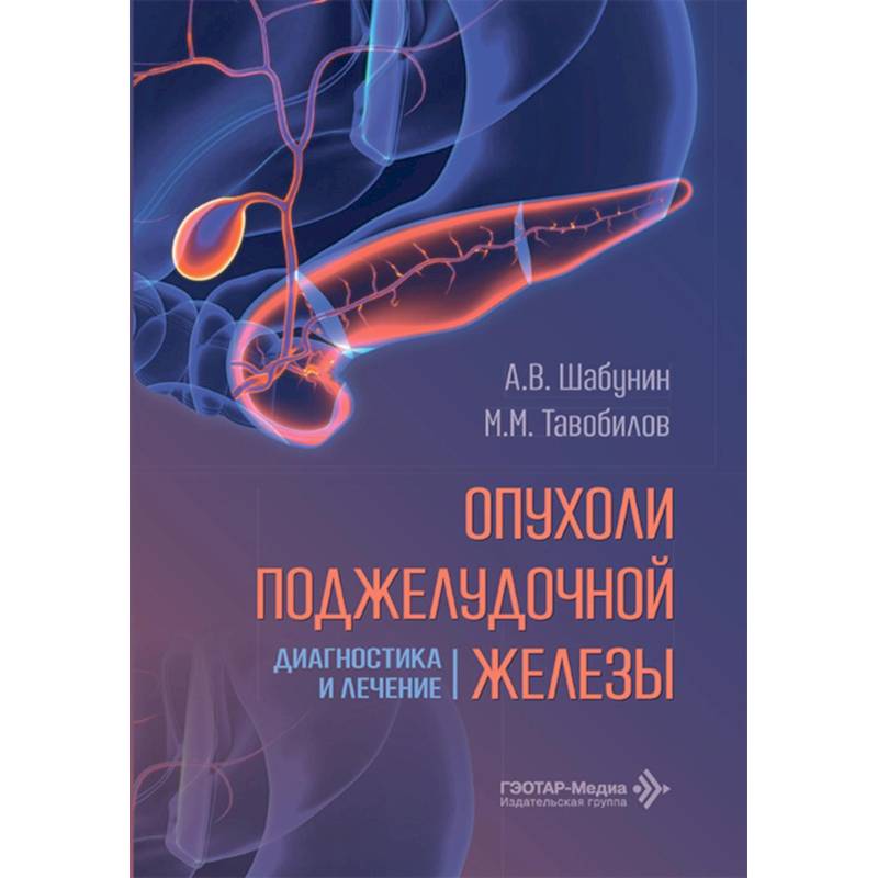 Фото Опухоли поджелудочной железы: диагностика и лечение