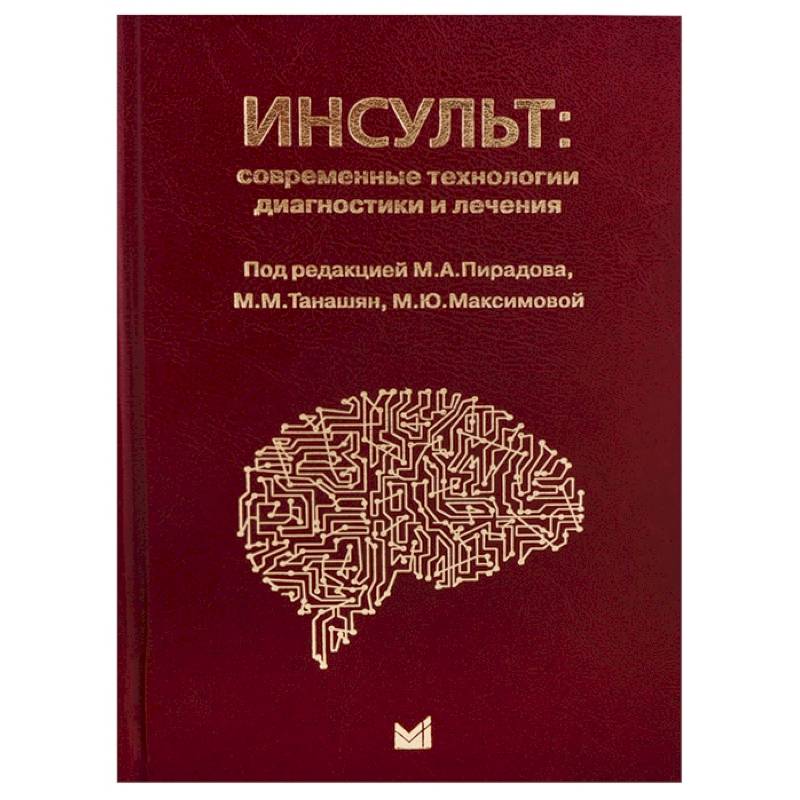 Фото Инсульт: современные технологии диагностики и лечения