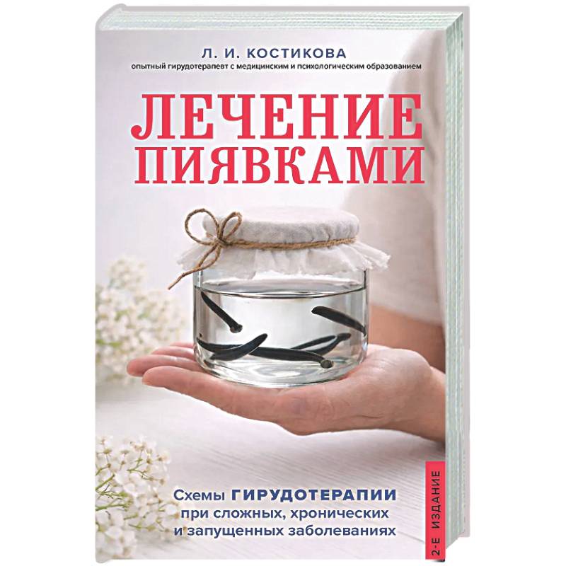 Фото Лечение пиявками. Схемы гирудотерапии при сложных, хронических и запущенных заболеваниях