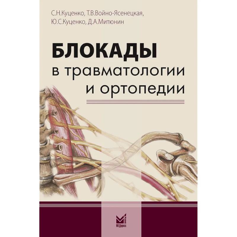 Фото Блокады в травматологии и ортопедии