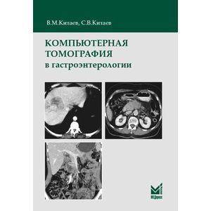 Фото Компьютерная томография в гастроэнтерологии
