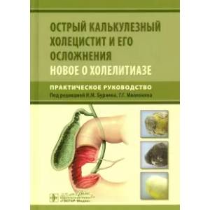 Фото Острый калькулезный холецистит и его осложнения. Новое о холелитиазе. Практическое руководство