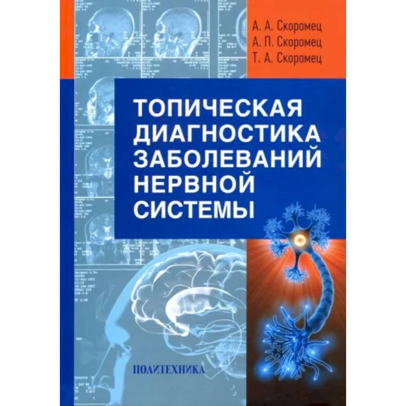 Фото Топическая диагностика заболеваний нервной системы. Руководство для врачей