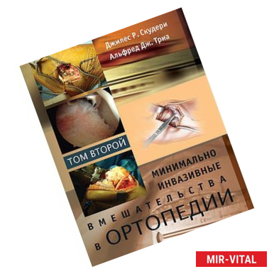 Фото Минимально инвазивные вмешательства в ортопедии. В 2 томах. Том 2