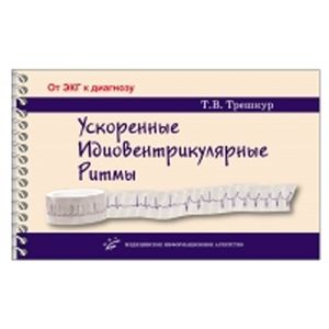 Фото Ускоренные идиовентрикулярные ритмы: клинико-электрокардиографические особенности, систематизация по ЭКГ-характеристикам, дифференцирован