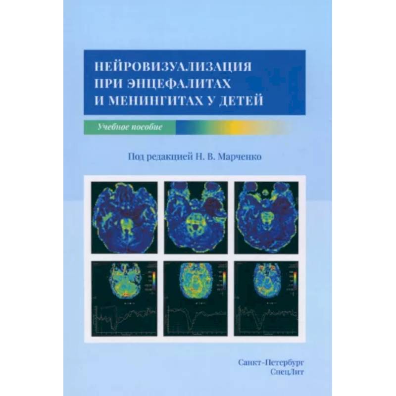 Фото Нейровизуализация при энцефалитах и менингитах у детей
