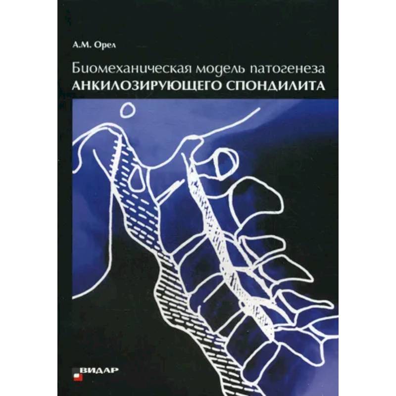 Фото Биомеханическая модель патогенеза акилозирующего спондилита