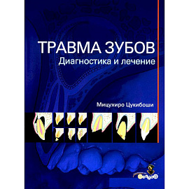 Травма зубов. Диагностика и лечение