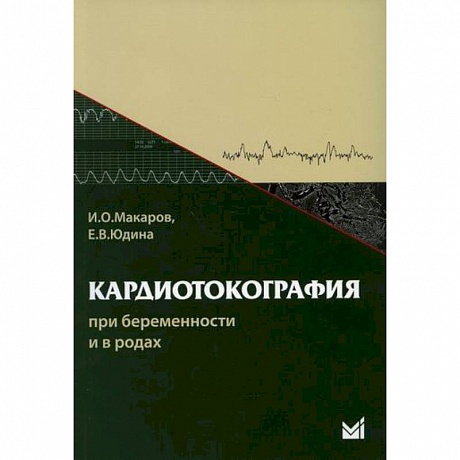 Фото Кардиотокография при беременности и в родах