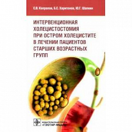 Интервенционная холецистостомия при остром холецистите в лечении пациентов старших возрастных групп