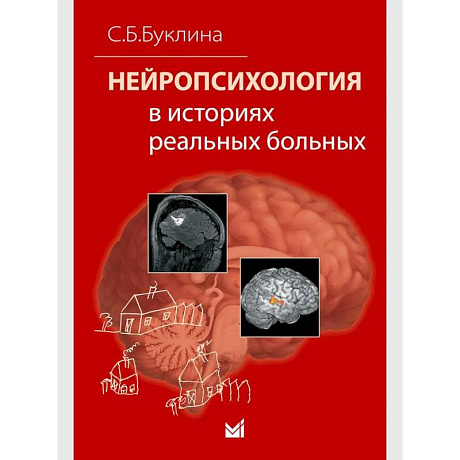 Фото Нейропсихология в историях реальных больных