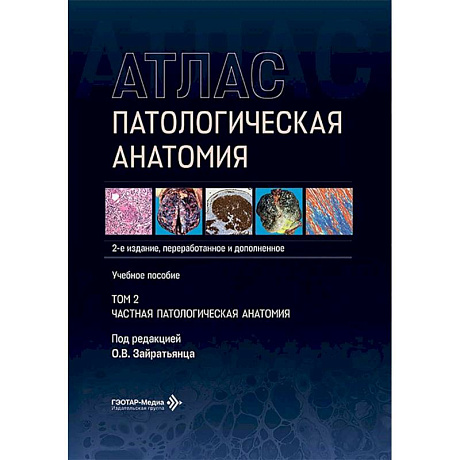 Фото Патологическая анатомия. Атлас.. Том  2: Частная патологическая анатомия: Учебное пособие.