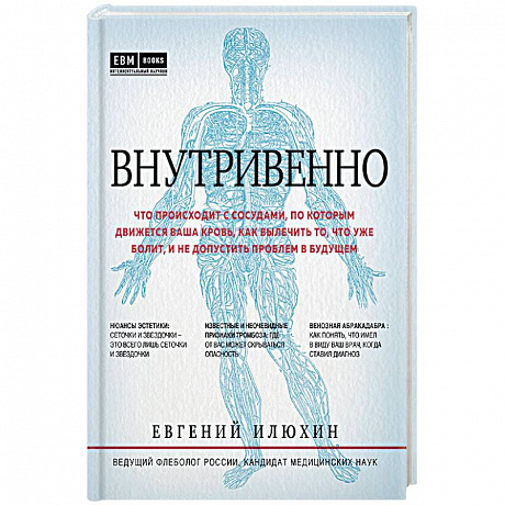 Фото Внутривенно. Что происходит с сосудами, по которым движется ваша кровь, как вылечить то, что уже болит, и не допустить проблем в будущем
