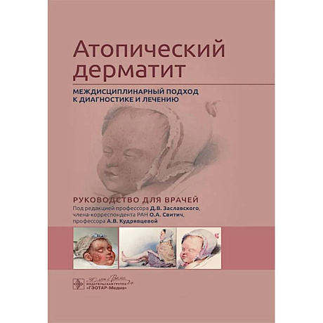 Фото Атопический дерматит. Междисциплинарный подход к диагностике и лечению: руководство для врачей