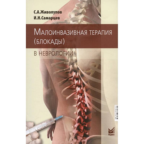 Фото Малоинвазивная терапия (блокады) в неврологии