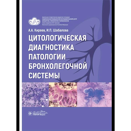 Фото Цитологическая диагностика патологии бронхолегочной системы