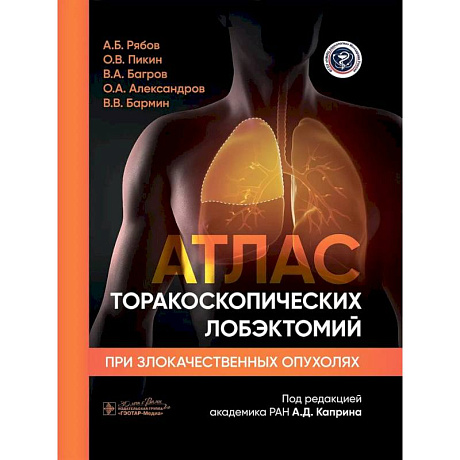 Фото Атлас торакоскопических лобэктомий при злокачественных опухолях
