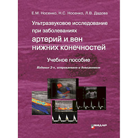 Ультразвуковое исследование при заболеваниях артерий и вен нижних конечностей: Учебное пособие. 2-е издание,исправленное и дополненное