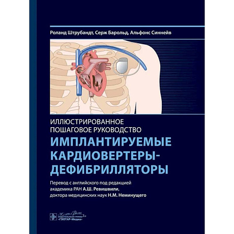 Фото Имплантируемые кардиовертеры-дефибрилляторы. Иллюстрированное пошаговое руководство
