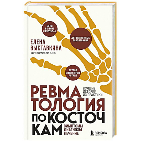 Фото Ревматология по косточкам. Симптомы, диагнозы, лечение